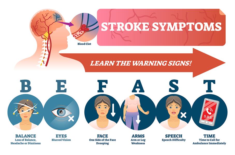 Signs of a Stroke l Heart and Vascular l Skagit Regional Health